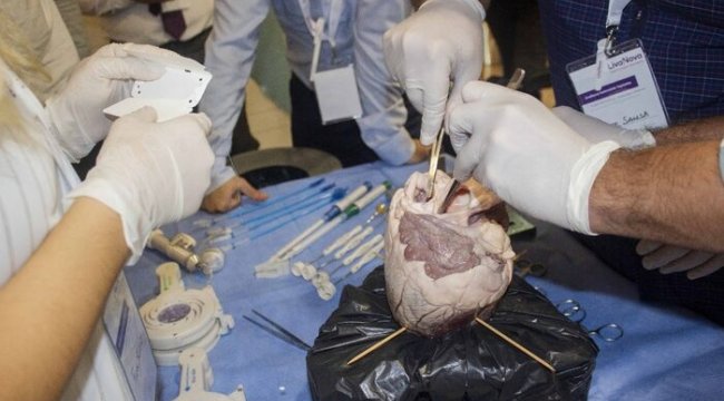 Sığır kalbi ile uygulamalı kalp kapağı operasyonu