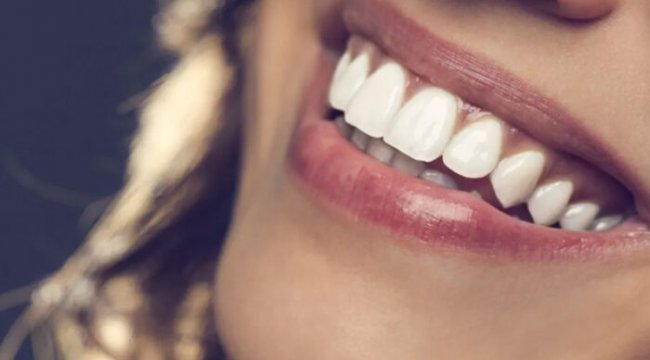 Ortodontik tedavilerde sağlam dişler neden çekilir?