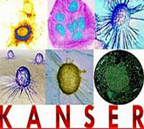 Kanser nedir ?