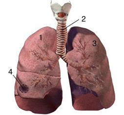 Akciğer apseleri