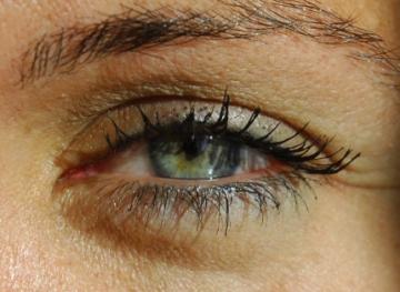 Göz tansiyonu hastalığı (Glokom = Karasu)