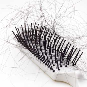 Saç kaybı hakkındaki mitler ve gerçekler