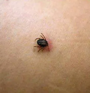 2014 yılının ilk kene vakası