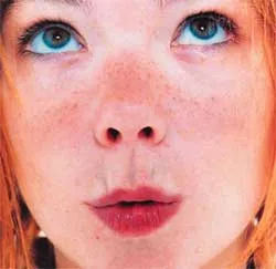 Cilt lekeleri kabusunuz olmasın