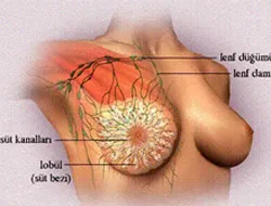 Göğüs ve prostat kanserinin gizemi çözülüyor