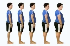 Obezite nedir ? Obezite neden olur ? Obezite tedavisi ?