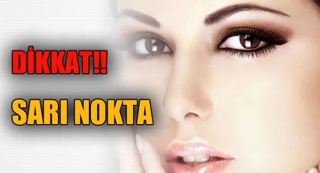 Sarı nokta (Gören nokta) veya makul hastalığı